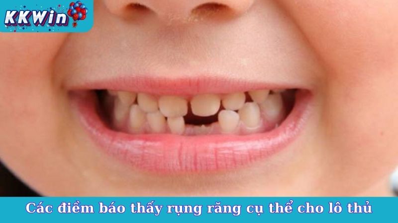 Các điềm báo thấy rụng răng cụ thể cho lô thủ
